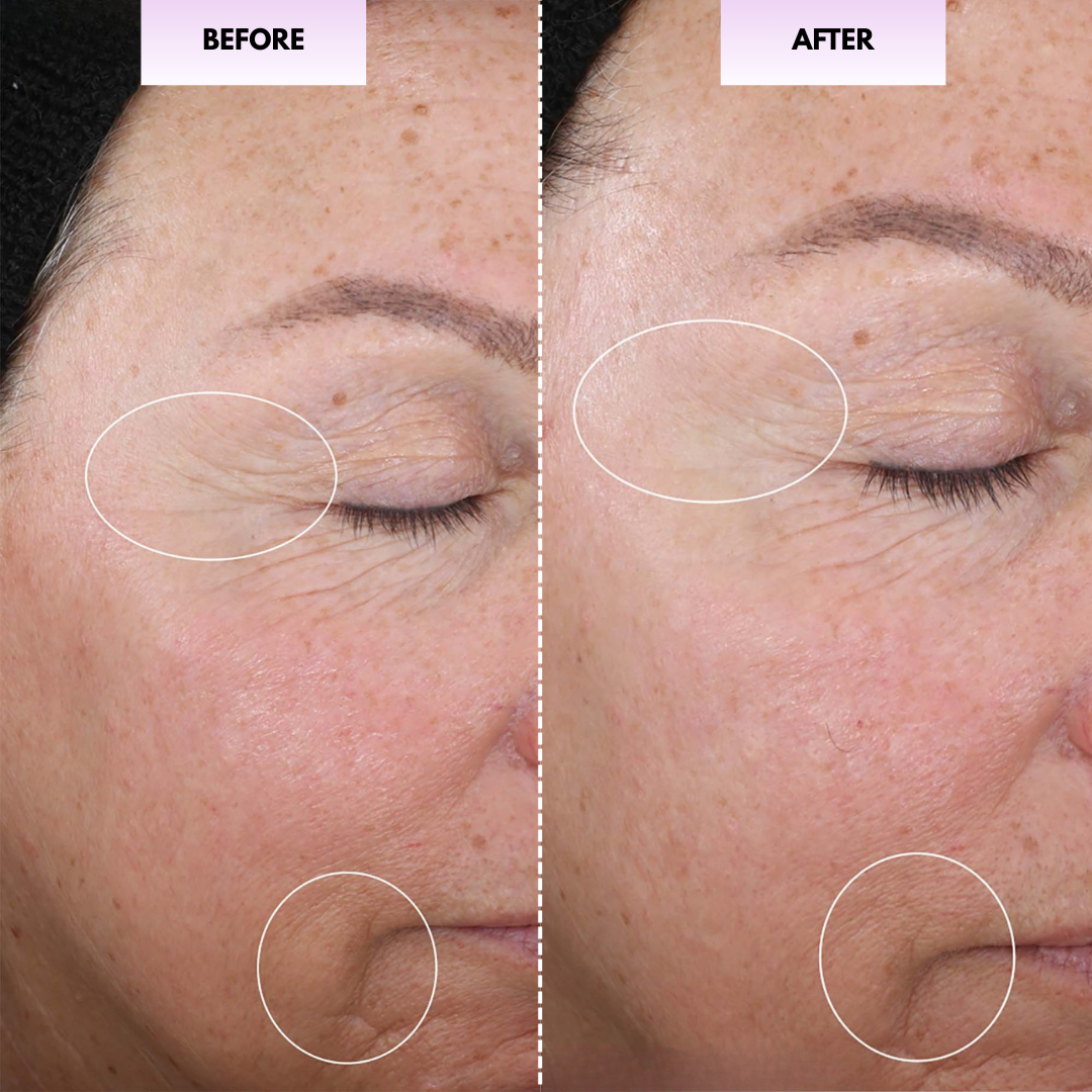 Facial Massaging Beauty Roller
