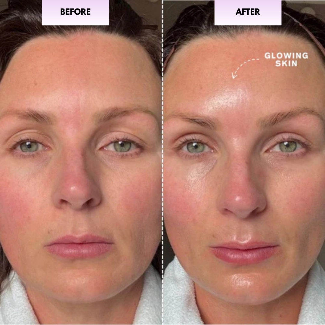 Facial Massaging Beauty Roller