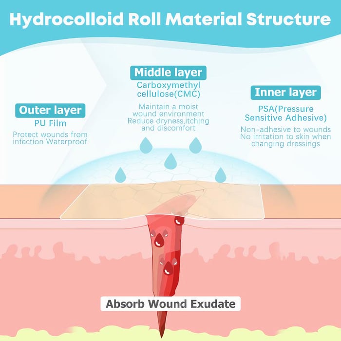 Hydrocolloid Roll for Wound Care
